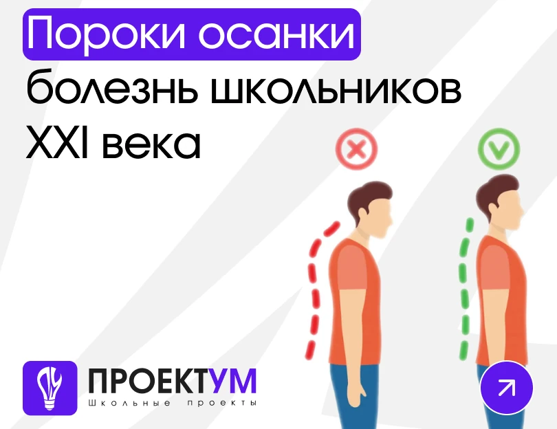 Индивидуальный проект «Пороки осанки — болезнь школьников XXI века» — обложка готовой работы